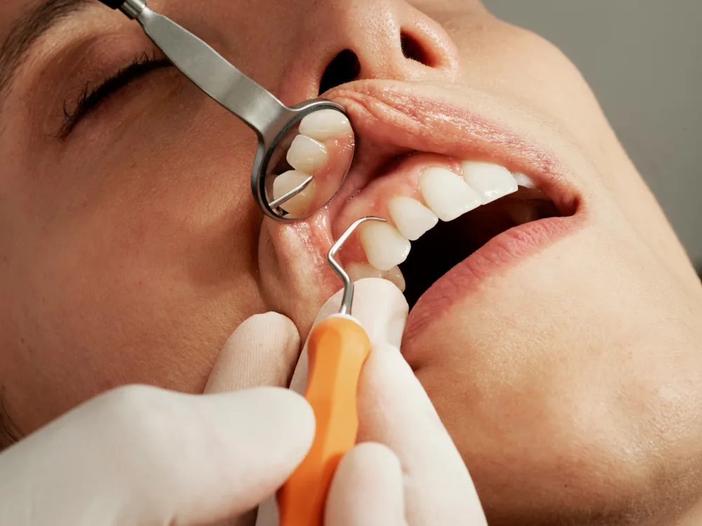 Examen dental de cerca